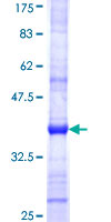NOT1 / CNOT1 Protein - 12.5% SDS-PAGE Stained with Coomassie Blue.