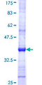 NOT1 / CNOT1 Protein - 12.5% SDS-PAGE Stained with Coomassie Blue.
