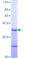 NOTCH1 Protein - 12.5% SDS-PAGE Stained with Coomassie Blue.