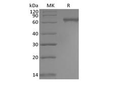 NOTCH2 Protein - Recombinant Human Notch2 (C-6His)