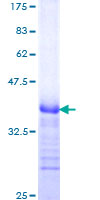 NOTCH2 Protein - 12.5% SDS-PAGE Stained with Coomassie Blue.