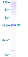 NOTCH2NL Protein - 12.5% SDS-PAGE of human NOTCH2NL stained with Coomassie Blue