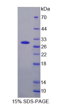 NOTCH2NL Protein - Recombinant  Notch2 N-Terminal Like Protein By SDS-PAGE