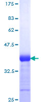 NOTCH3 Protein - 12.5% SDS-PAGE Stained with Coomassie Blue.