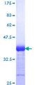 NOTCH3 Protein - 12.5% SDS-PAGE Stained with Coomassie Blue.