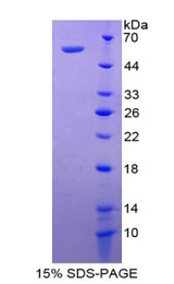 NOTCH3 Protein - Recombinant Notch Homolog 3 By SDS-PAGE