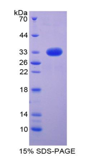 NOTCH4 Protein