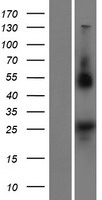 NOTO Protein - Western validation with an anti-DDK antibody * L: Control HEK293 lysate R: Over-expression lysate