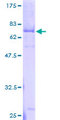 NOTUM Protein - 12.5% SDS-PAGE of human LOC147111 stained with Coomassie Blue