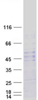 NOTUM Protein - Purified recombinant protein NOTUM was analyzed by SDS-PAGE gel and Coomassie Blue Staining