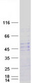 NOTUM Protein - Purified recombinant protein NOTUM was analyzed by SDS-PAGE gel and Coomassie Blue Staining