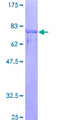 NOVA1 Protein - 12.5% SDS-PAGE of human NOVA1 stained with Coomassie Blue