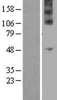 NOX4 Protein - Western validation with an anti-DDK antibody * L: Control HEK293 lysate R: Over-expression lysate
