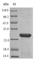 NOX4 Protein - (Tris-Glycine gel) Discontinuous SDS-PAGE (reduced) with 5% enrichment gel and 15% separation gel.