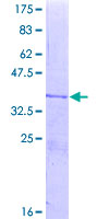 NOX4 Protein - 12.5% SDS-PAGE Stained with Coomassie Blue.