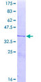 NOX4 Protein - 12.5% SDS-PAGE Stained with Coomassie Blue.