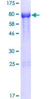 NOXA1 Protein - 12.5% SDS-PAGE of human NOXA1 stained with Coomassie Blue