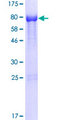 NOXA1 Protein - 12.5% SDS-PAGE of human NOXA1 stained with Coomassie Blue