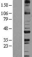 NOXO1 Protein - Western validation with an anti-DDK antibody * L: Control HEK293 lysate R: Over-expression lysate
