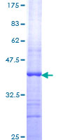 NOXO1 Protein - 12.5% SDS-PAGE Stained with Coomassie Blue.
