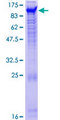 NPAS2 Protein - 12.5% SDS-PAGE of human NPAS2 stained with Coomassie Blue