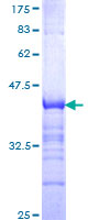 NPAS2 Protein - 12.5% SDS-PAGE Stained with Coomassie Blue.