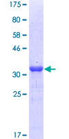 NPC / NPC1 Protein - 12.5% SDS-PAGE Stained with Coomassie Blue.