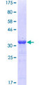 NPC / NPC1 Protein - 12.5% SDS-PAGE Stained with Coomassie Blue.
