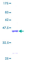 NPC2 Protein - 12.5% SDS-PAGE of human NPC2 stained with Coomassie Blue