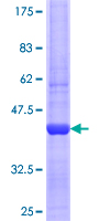 NPC2 Protein - 12.5% SDS-PAGE Stained with Coomassie Blue.