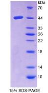 NPC2 Protein - Recombinant  Niemann Pick Disease Type C2 By SDS-PAGE