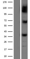 NPEPPS Protein - Western validation with an anti-DDK antibody * L: Control HEK293 lysate R: Over-expression lysate