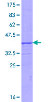 NPEPPS Protein - 12.5% SDS-PAGE Stained with Coomassie Blue.