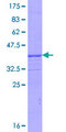 NPEPPS Protein - 12.5% SDS-PAGE Stained with Coomassie Blue.