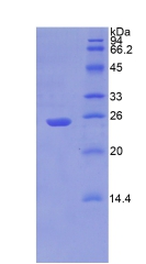 NPEPPS Protein - Recombinant Puromycin Sensitive Aminopeptidase By SDS-PAGE