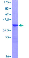 NPHP1 / Nephronophthisis Protein - 12.5% SDS-PAGE of human NPHP1 stained with Coomassie Blue