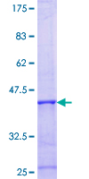 NPHP1 / Nephronophthisis Protein - 12.5% SDS-PAGE Stained with Coomassie Blue.