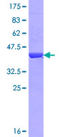 NPHP3 Protein - 12.5% SDS-PAGE Stained with Coomassie Blue.