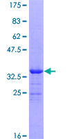 NPHP4 Protein - 12.5% SDS-PAGE of human NPHP4 stained with Coomassie Blue