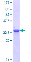NPHS1 / Nephrin Protein - 12.5% SDS-PAGE Stained with Coomassie Blue.
