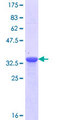 NPHS1 / Nephrin Protein - 12.5% SDS-PAGE Stained with Coomassie Blue.