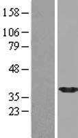 NPL / C112 Protein - Western validation with an anti-DDK antibody * L: Control HEK293 lysate R: Over-expression lysate