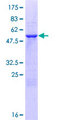 NPL / C112 Protein - 12.5% SDS-PAGE of human NPL stained with Coomassie Blue