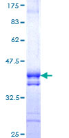 NPLOC4 Protein - 12.5% SDS-PAGE Stained with Coomassie Blue.