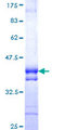 NPLOC4 Protein - 12.5% SDS-PAGE Stained with Coomassie Blue.