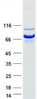 NPLOC4 Protein - Purified recombinant protein NPLOC4 was analyzed by SDS-PAGE gel and Coomassie Blue Staining