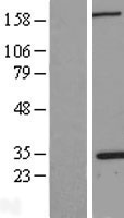 NPM1 / NPM / Nucleophosmin Protein - Western validation with an anti-DDK antibody * L: Control HEK293 lysate R: Over-expression lysate