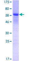 NPM1 / NPM / Nucleophosmin Protein - 12.5% SDS-PAGE of human NPM1 stained with Coomassie Blue
