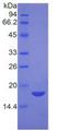 NPM1 / NPM / Nucleophosmin Protein - Recombinant Nucleophosmin By SDS-PAGE