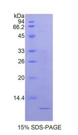 NPM1 / NPM / Nucleophosmin Protein - Recombinant Nucleophosmin By SDS-PAGE
